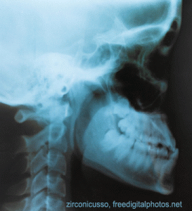 x-ray-skull